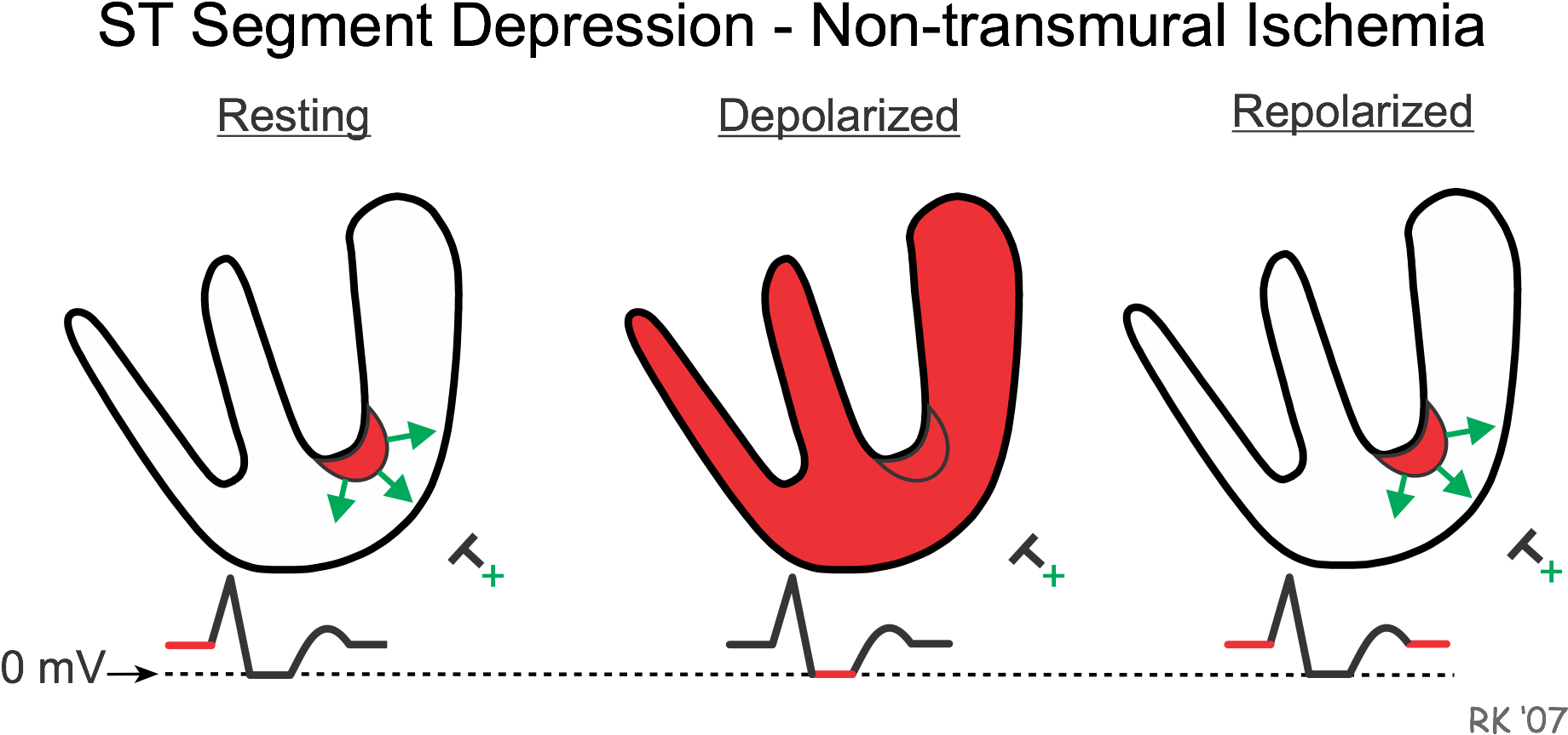 Cad012 St Depression Model - St Segment Elevation (1876x909), Png Download