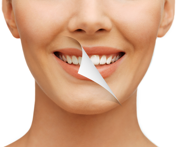 Gold Tooth Price In Cape Town ↺ - חיוך מושלם (623x517), Png Download