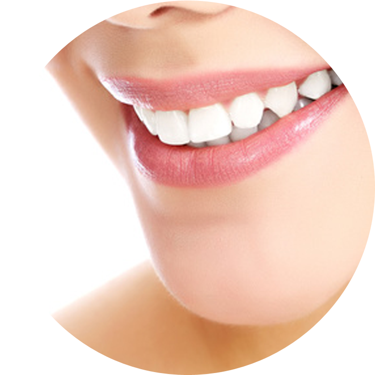 Crowns Are Called Indirect Restorations, Because The - White Teeth With Face Png (800x800), Png Download