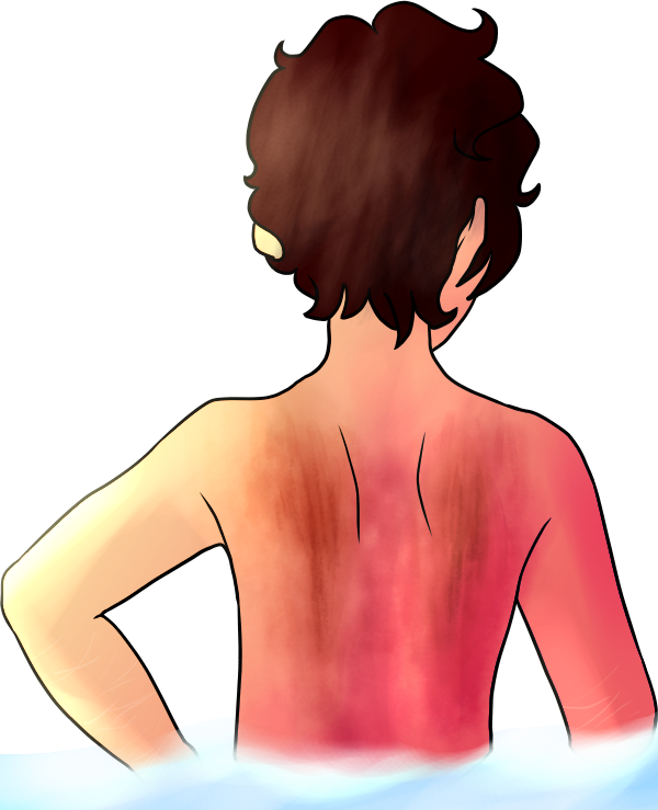 【﻿ｔｈｅ Ａｎｇｅｌ＇ｓ Ｓｃａｒｓ】 - Illustration (600x739), Png Download