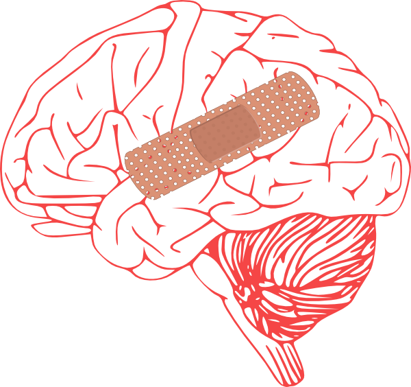 Brain Injury Clip Art At Clker - Stroke Clipart (600x564), Png Download